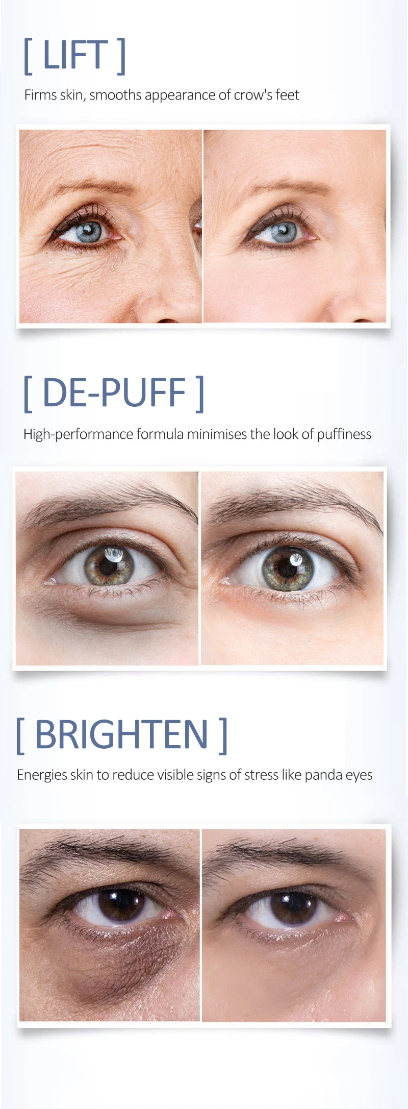 OCHEAL Eye Moisturizing Cream Fades Fine Lines Anti Dark Circles Eye Serum Remove Eye Bag Puffiness Anti-Aging Firmness Eye Care